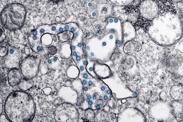 Microscope image of coronavirus