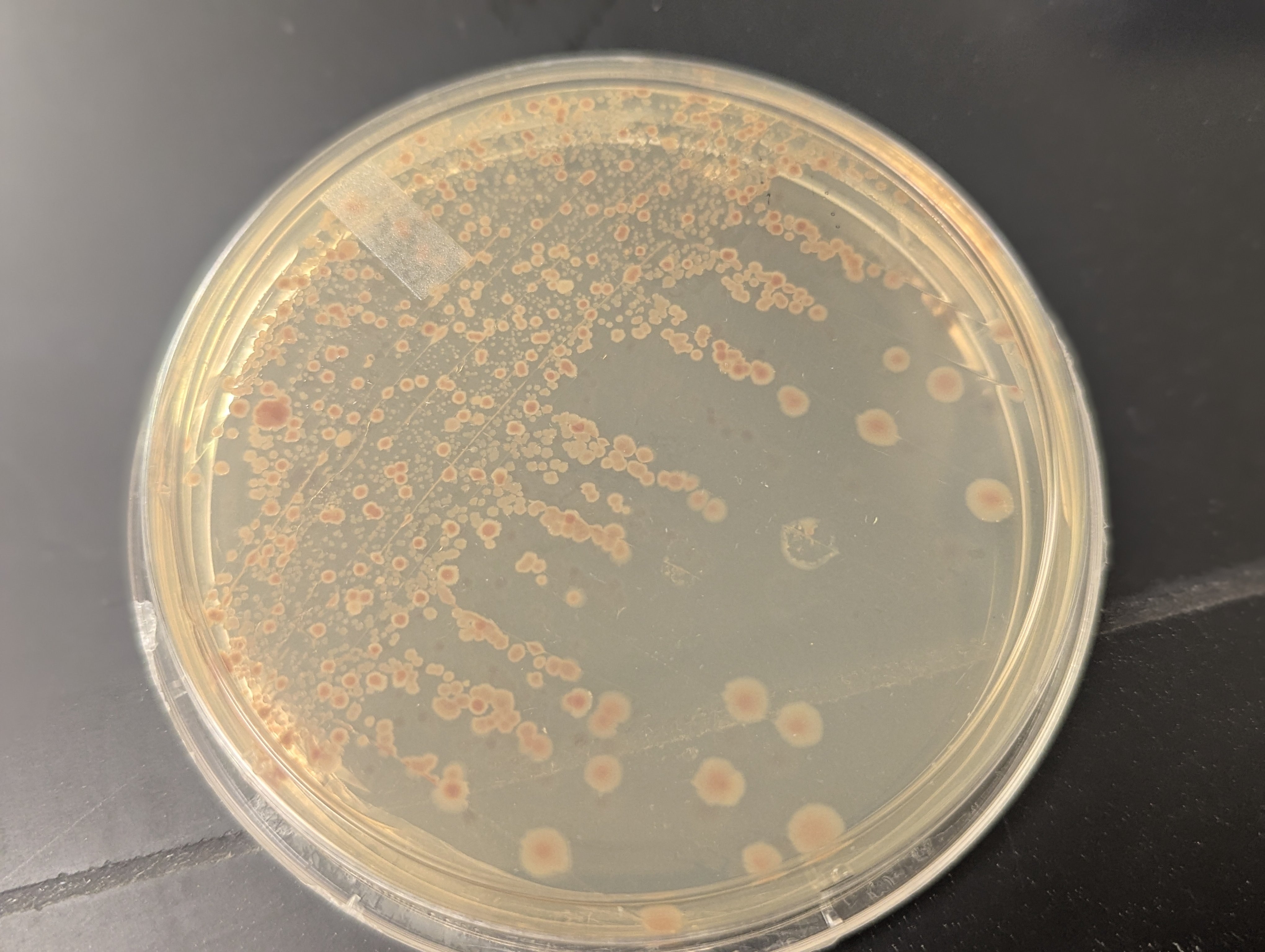 Engineered bacteria with added nutrients in Dr. Liu's lab that is part of her research into secreted nanoparticles.