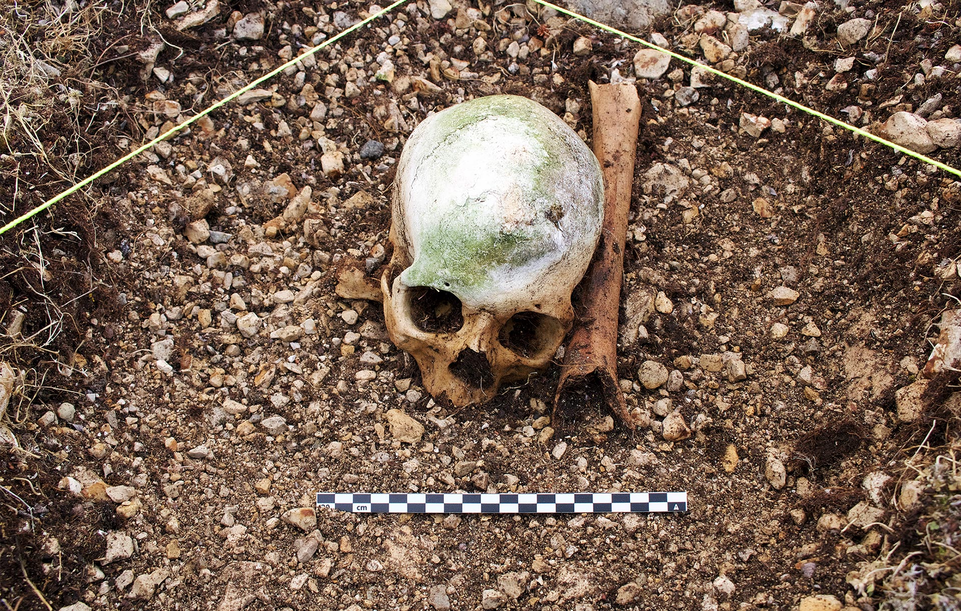 Picture of skull and bone
