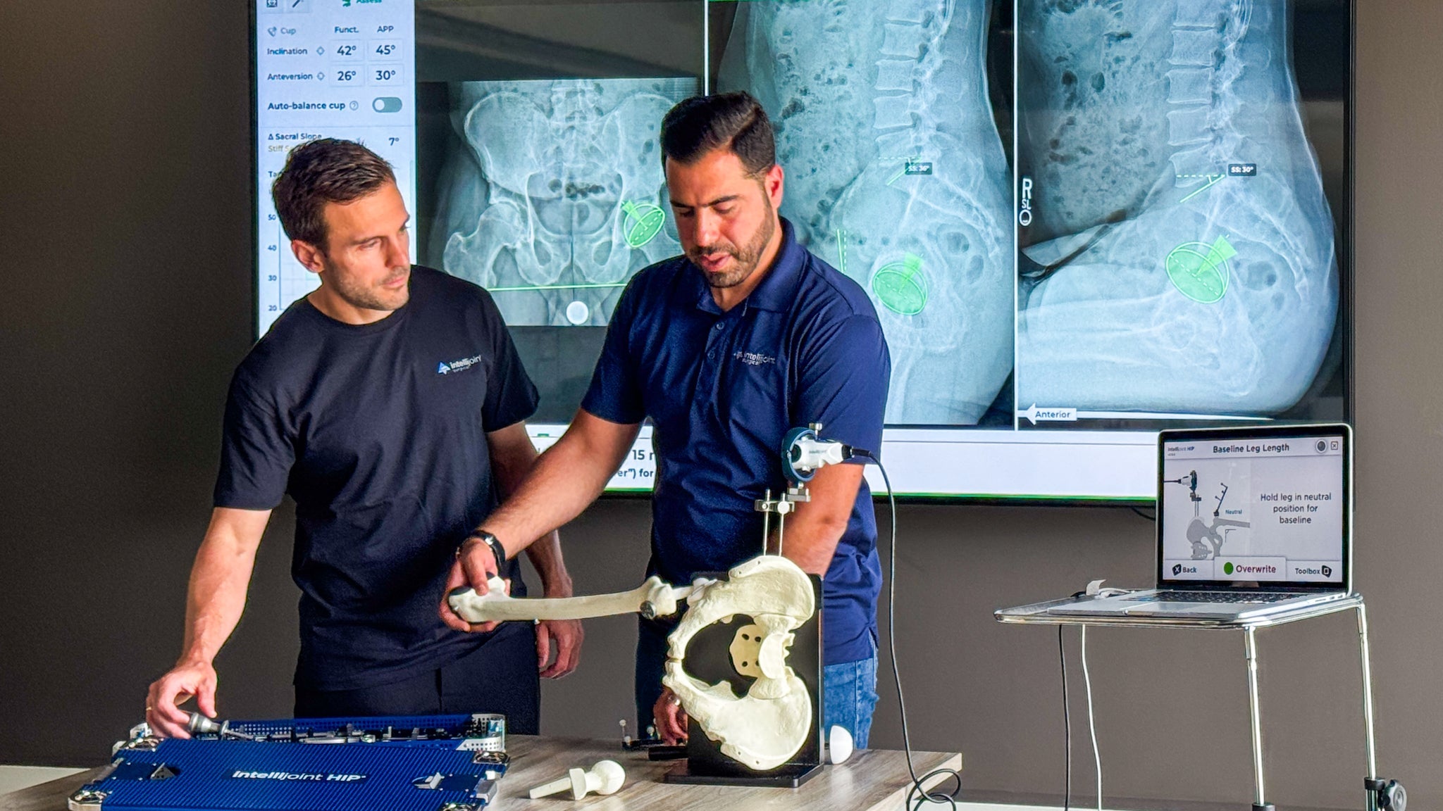 Two people demonstrate Intellijoint hip technology