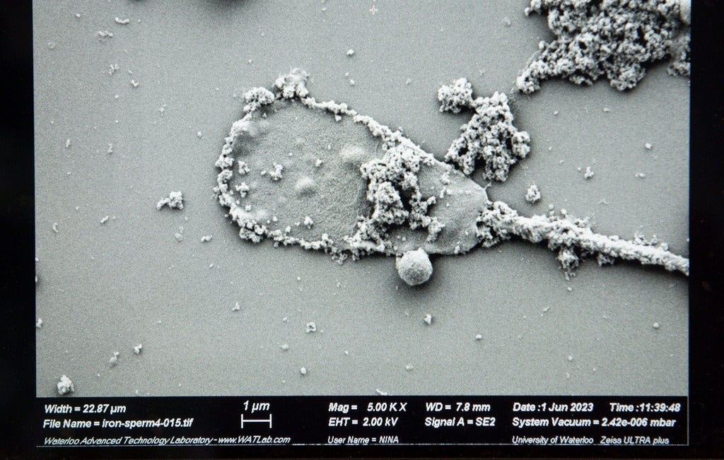 IRONSperm