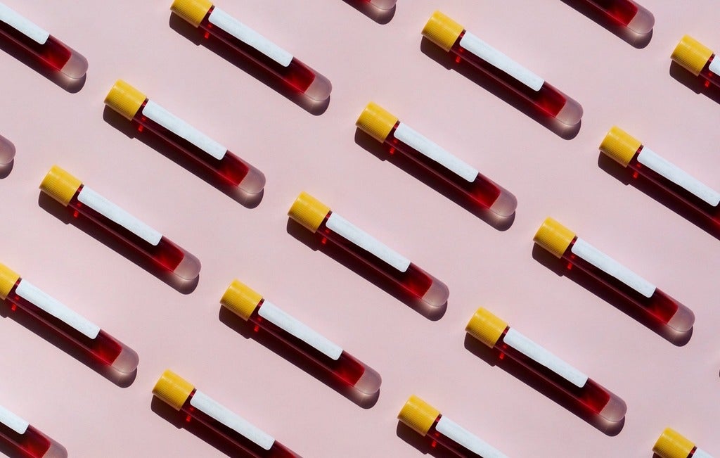 blood samples 