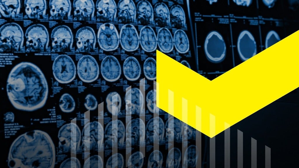 Brain scans