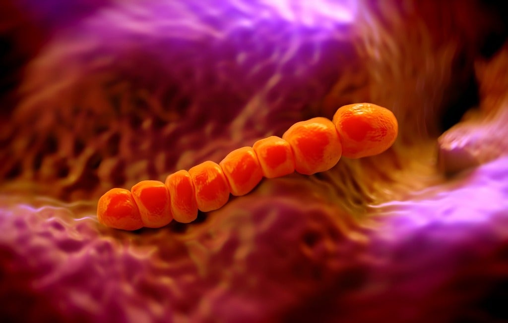 magnification of Streptococcus pneumoniae 