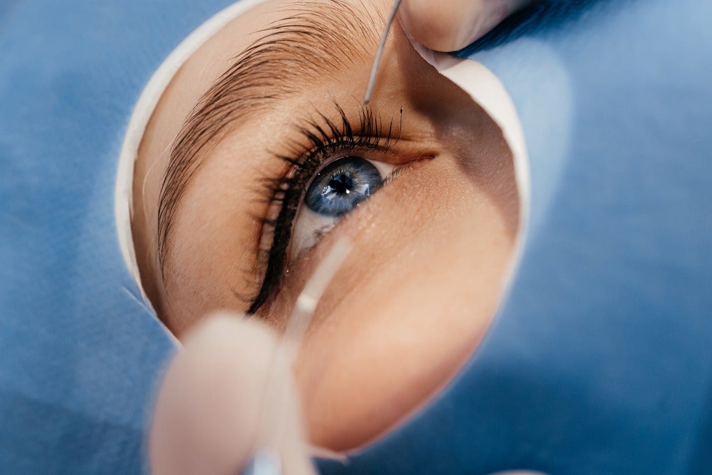 Close-up of a patient's eye during microsurgery.