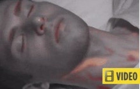 Still from video showing how light trackc blood flow. Article contains video