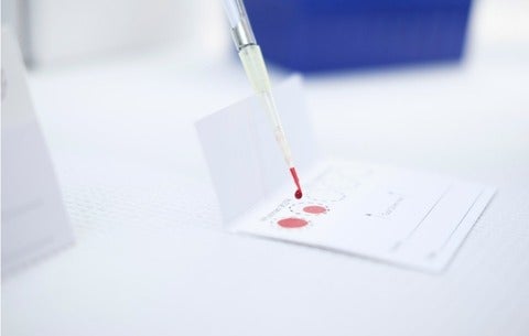 Blood test on sheet of paper