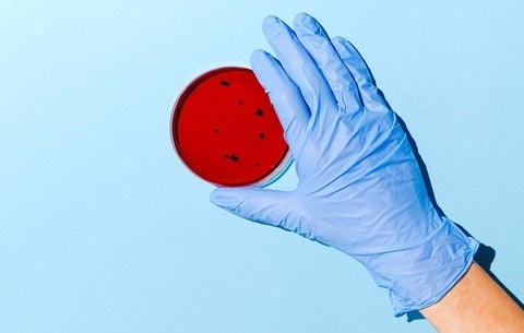 Hand wearing gloves holding a disk container filled with fluid