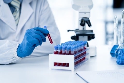 Doctor taking blood sample tube from rack with machines for analysis in the background. (Getty Images/Perawit Boonchu)