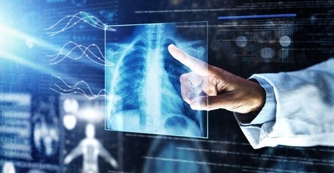 Medical lungs scan