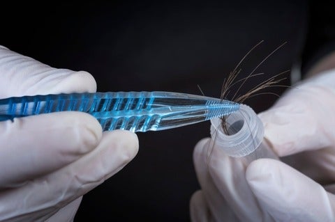 A scientist examining hair strands in a lab. (Getty Images/Sandra Matic)