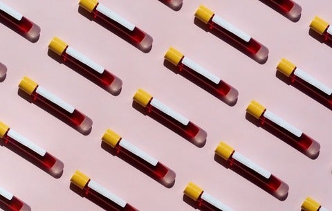 blood samples 
