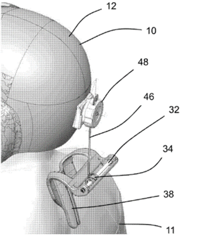 A schematic of the head system stabilization device as included in the US patent filing.