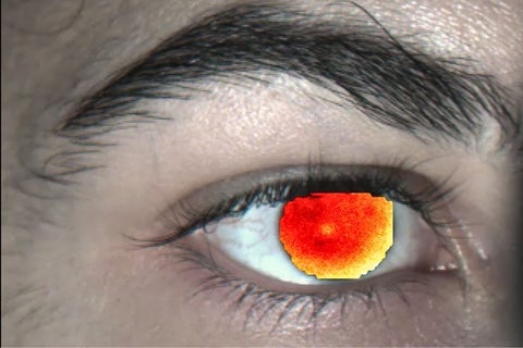 Eye showing surface temperature