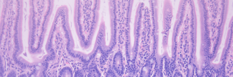 Brightfield image of mouse large intestines stained with Haemotoxylin and Eosin (H& E)