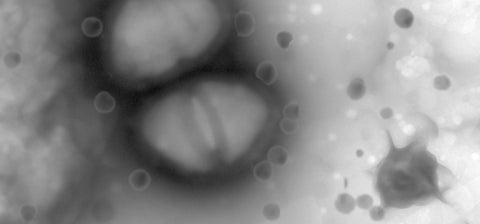 Two MSRA cells surrounded by solid lipid nanoparticles that have delivered a deadly biocide.