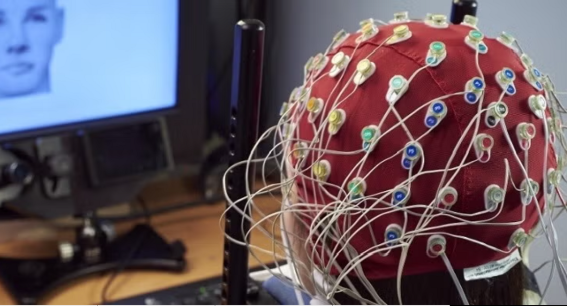 EEG scan