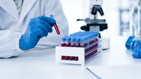 Researcher wearing lab coat places test tubes of blood into a tray.