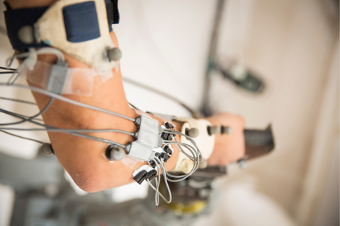 Right arm of a research subject with wires attached