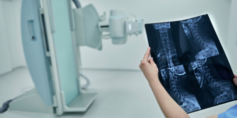 A medical professional holding an x-ray standing in front of an imaging machine