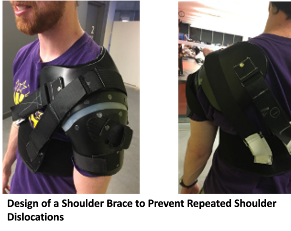 Design of a Shoulder Brace to Prevent Repeated Shoulder Dislocations