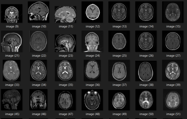 Brain MRI images - No tumor