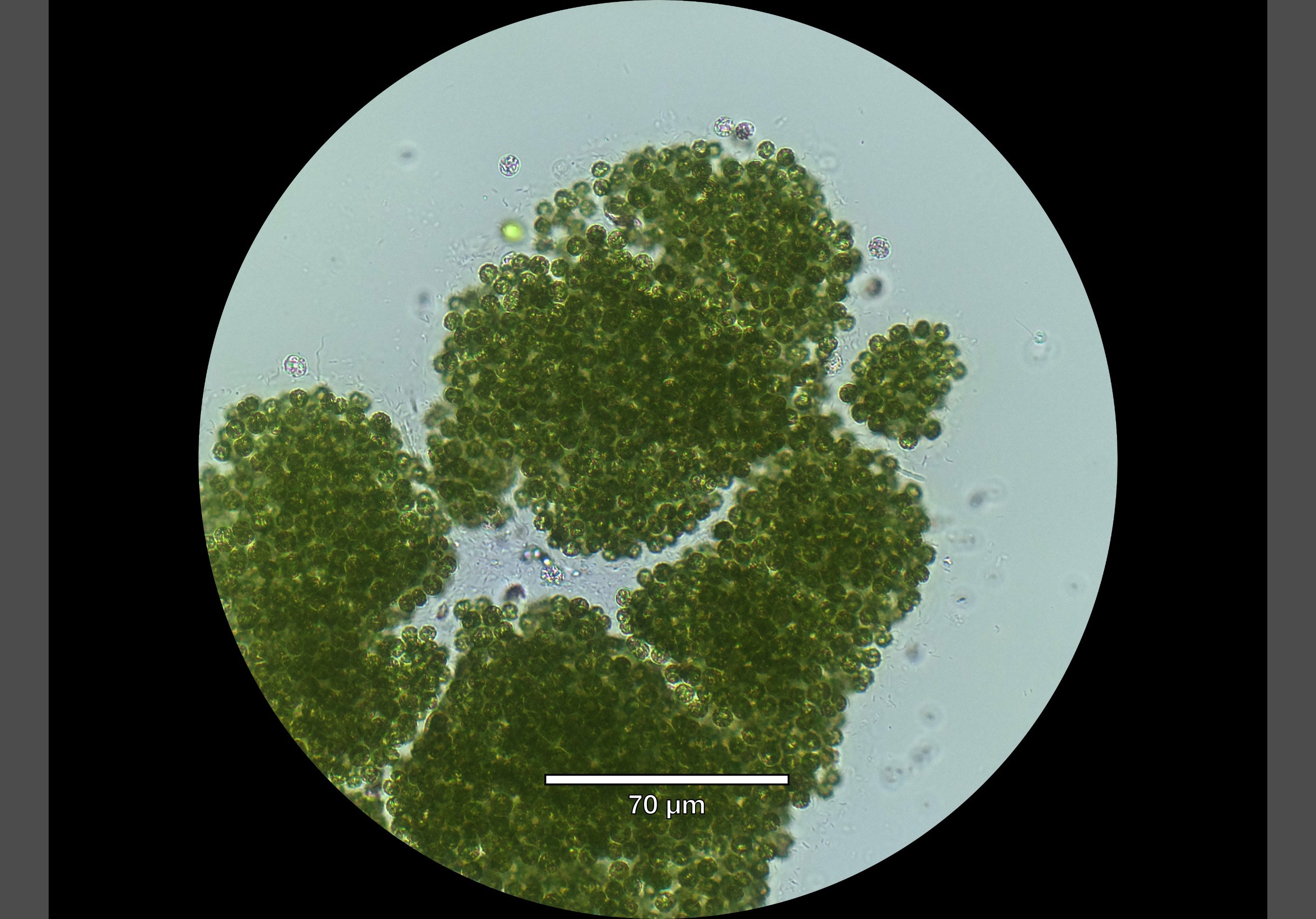 Microcystic aeruginosa under the microscope. 