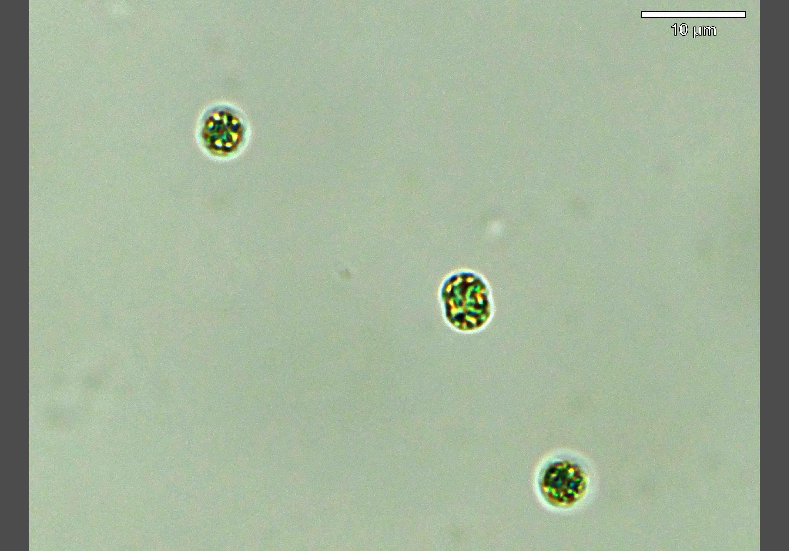 Microscope view of microcystis. 