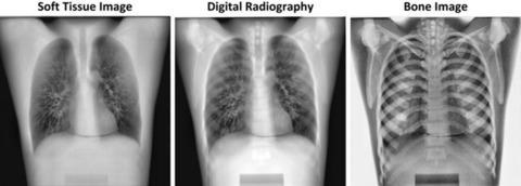 Sample images made with X-ray technology developed by Waterloo Engineering startup KA Imaging.