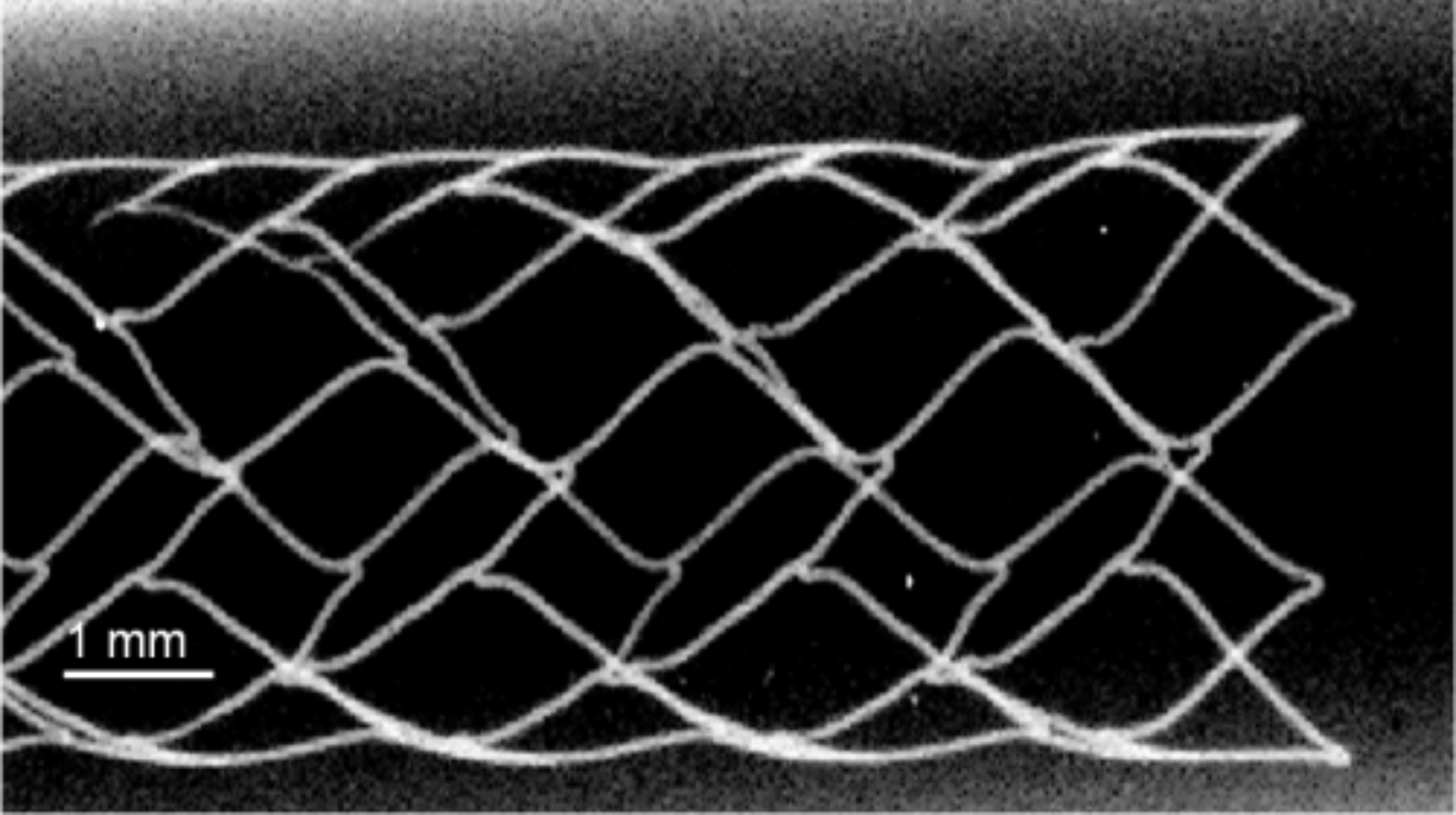 25-50 micron wire diameter aorta stent