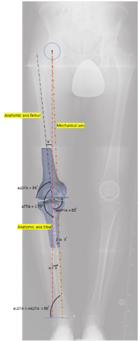 skeleton model with marks in leg x ray