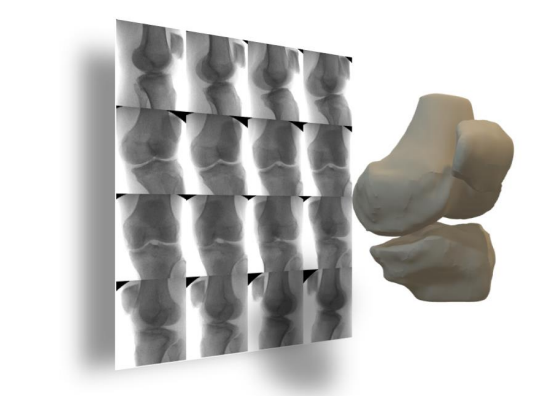 Array of x-ray images of knee at arbitary points of leg rotation