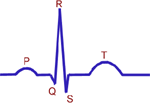 example recording of electrocardiogram