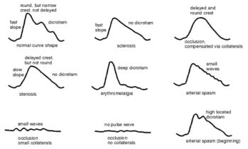 diagram portraying the different types of signals
