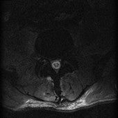 dark photo of a MRI slice 