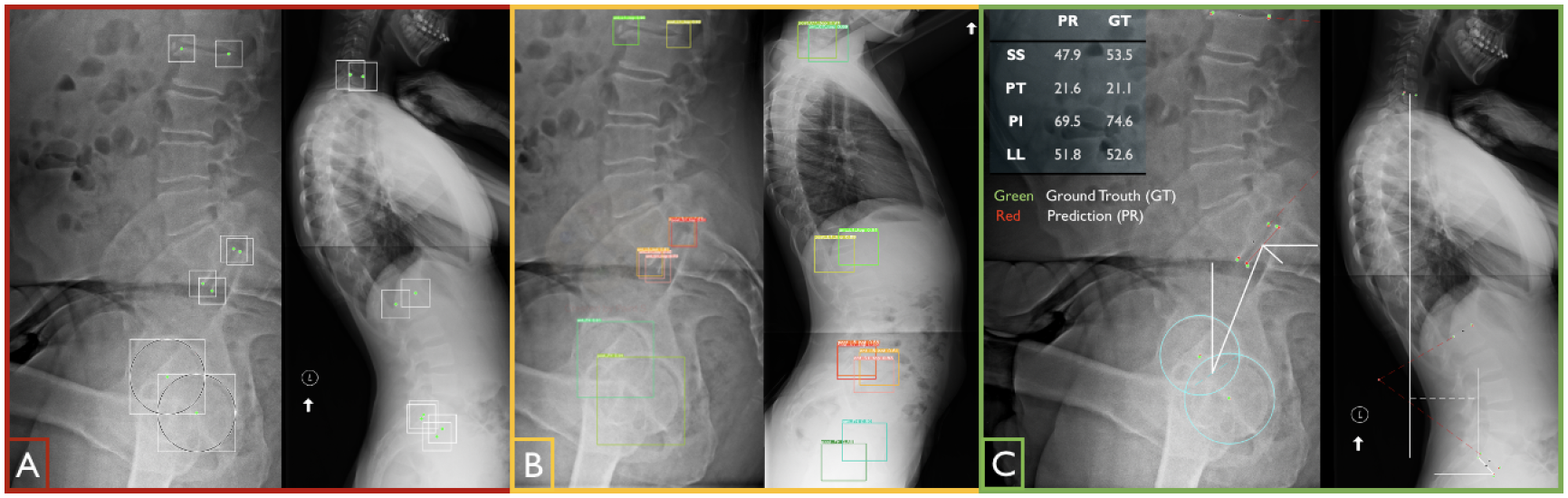 spinopelvic x-rays