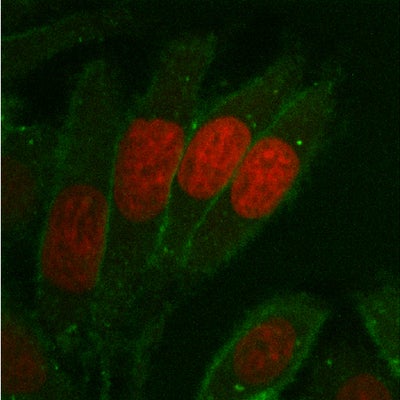 SWNT in cells (green: SWNT; red: DRAQ5 stained nucleus)