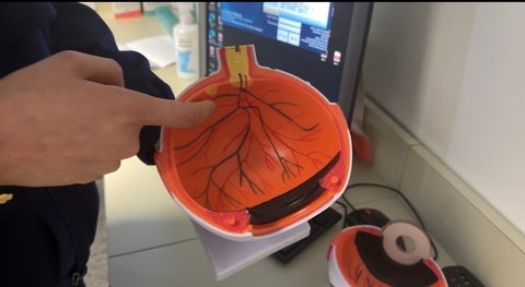 Image showing the arterties of the eye