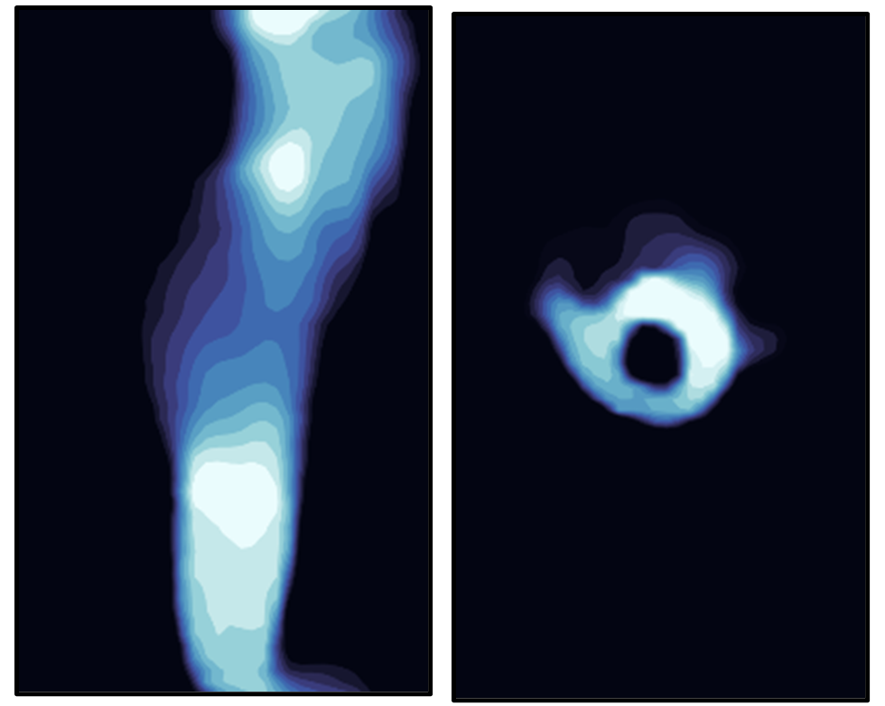 Other tomography modalities