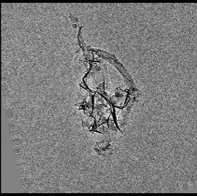 A tomographic images of nanoparicles