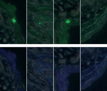 In vivo transfection activity of gemini surfactant-based nanoparticles.